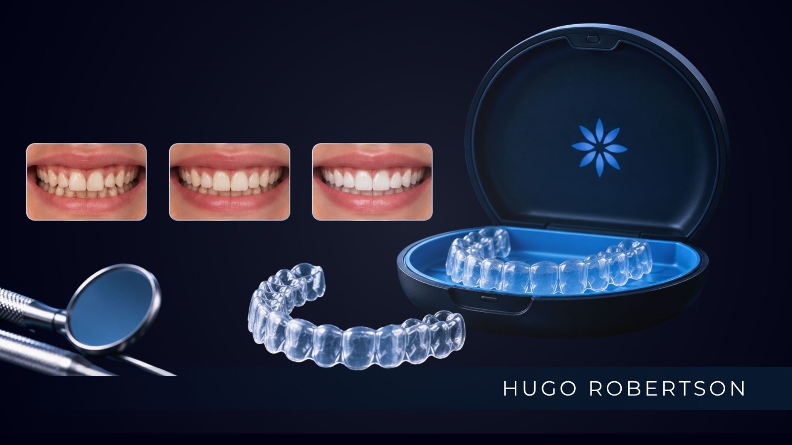 Invisalign: quanto custa e o que influencia o preço
