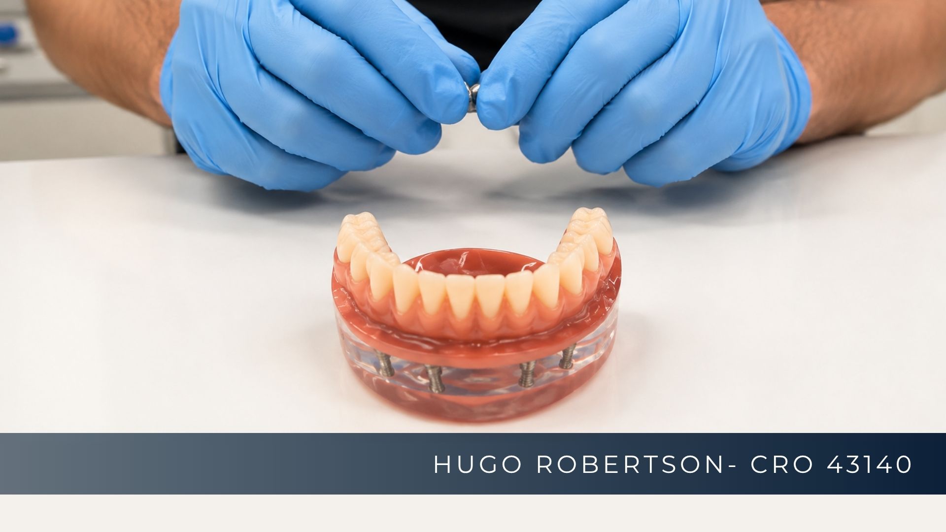 Prótese Protocolo fixa sobre implantes para reabilitação completa do sorriso
