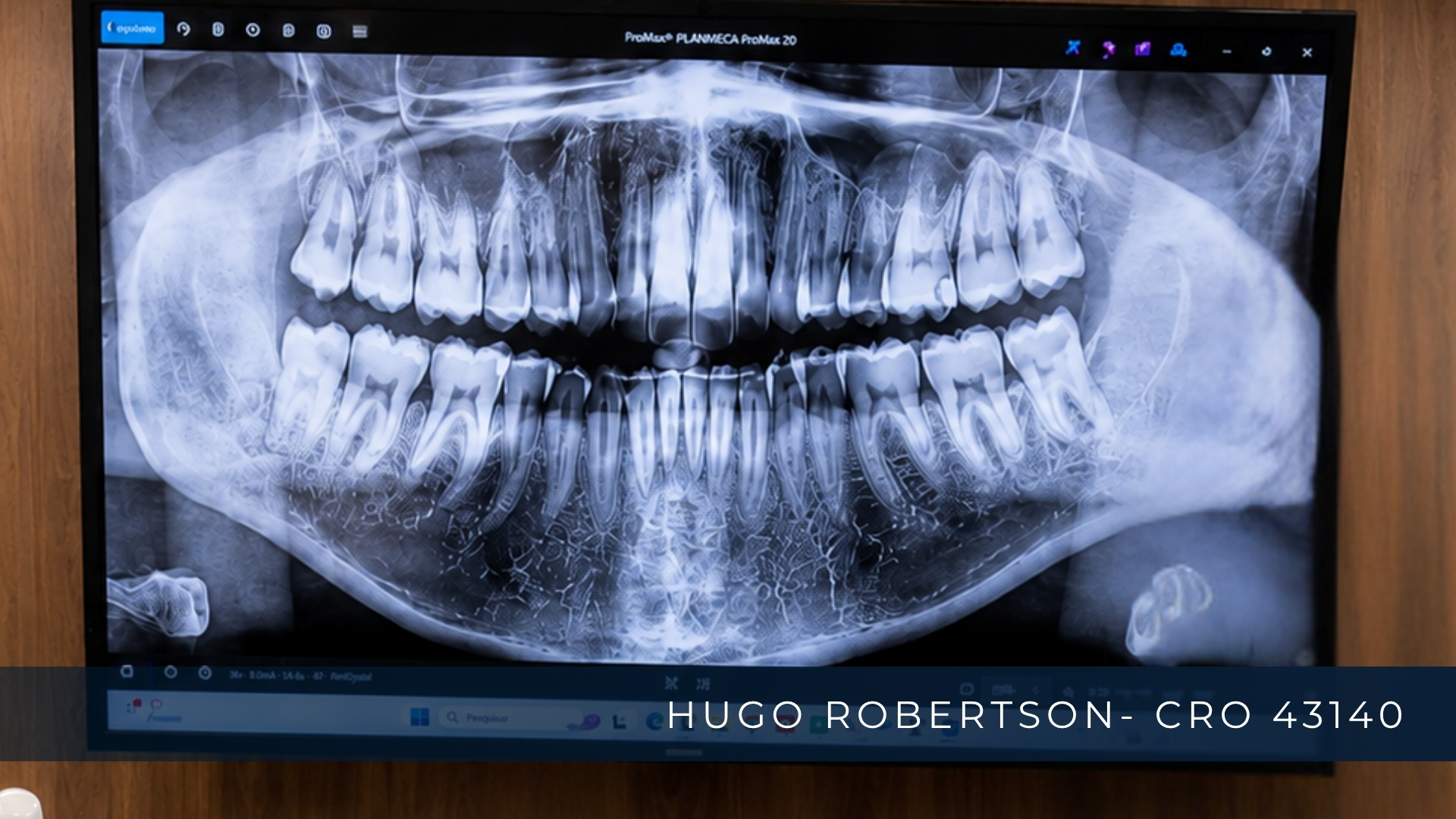 radiografia-panoramica-implante-dentario