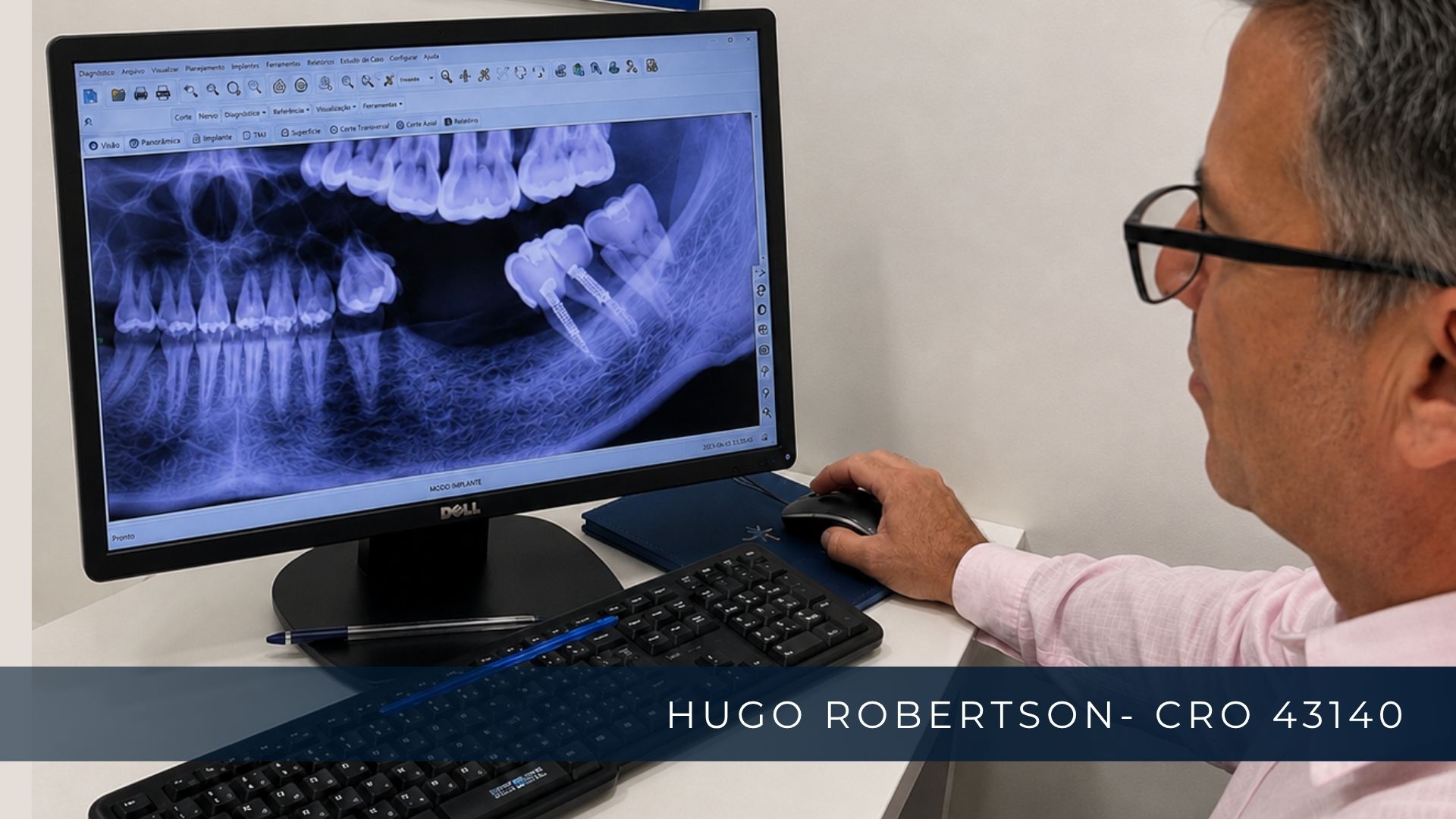 dr hugo planejamento protese protocolo.jpg   ALT  Dr. Hugo Robertson analisando planejamento digital de Prótese Protocolo