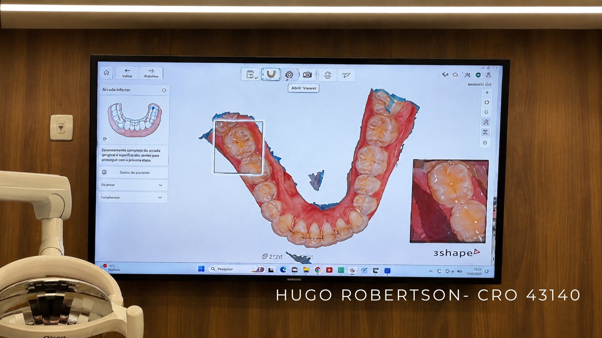 scanner-intraoral-implante-dentario