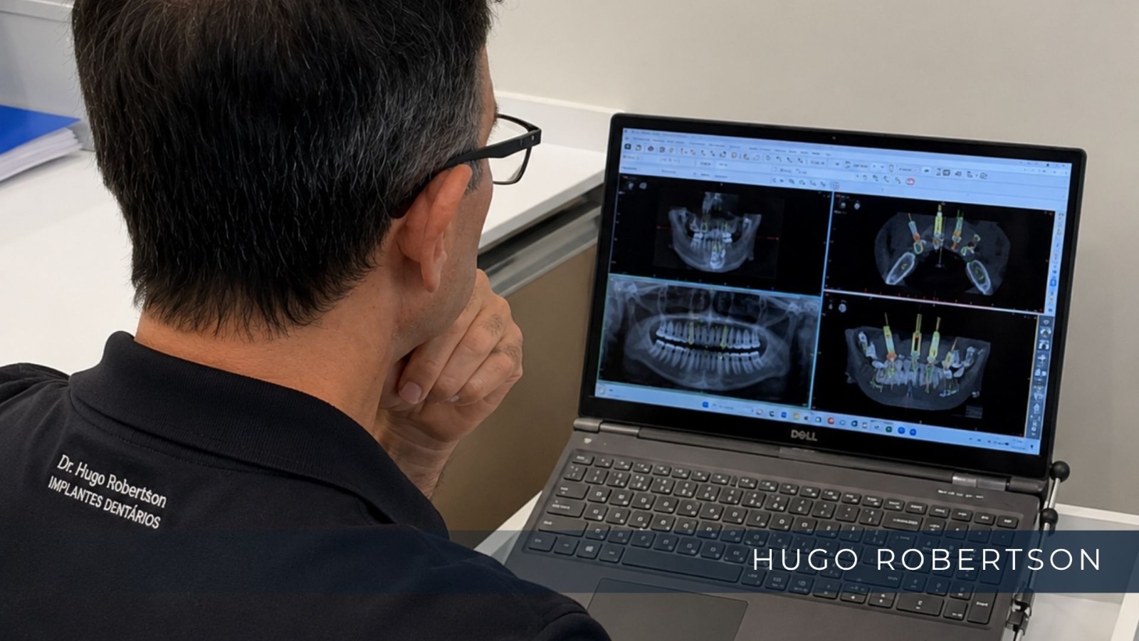 dr hugo robertson cirurgia por computador