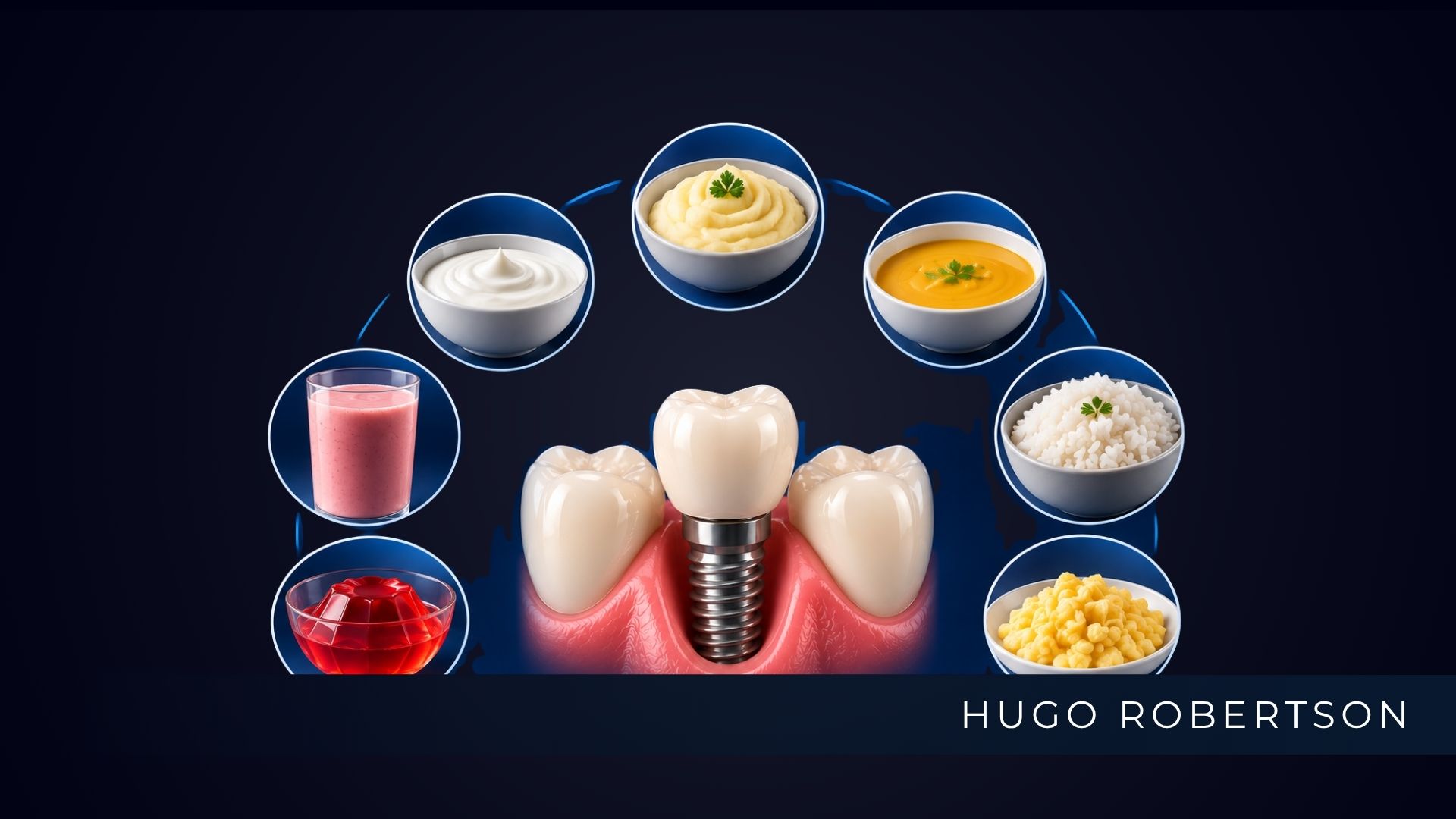 O Que Comer Depois do Implante Dentário: alimentação por fases