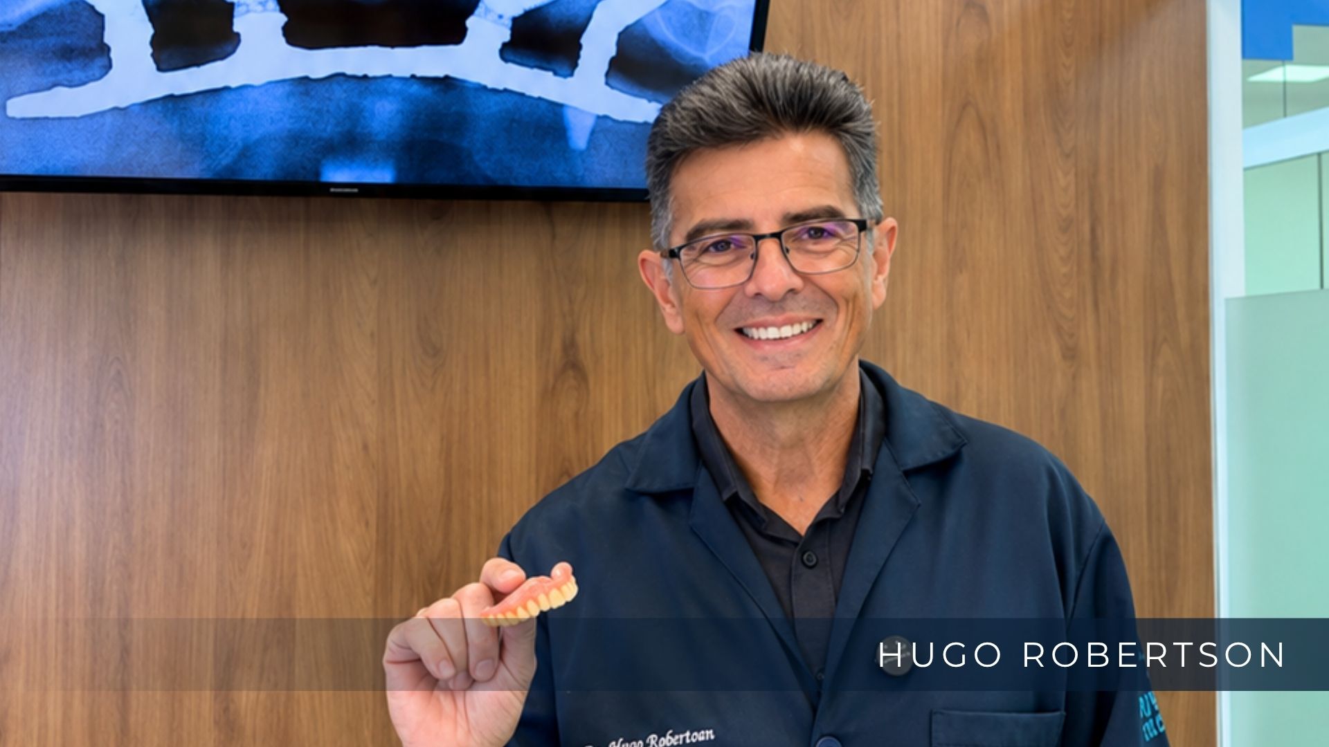 Prótese Protocolo sobre implantes produzida no laboratório digital da Odontoclinic Vila Mariana.
