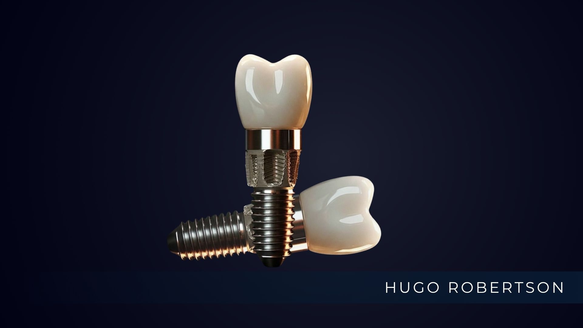 Avaliação de manutenção de implante dentário na Odontoclinic Vila Mariana.