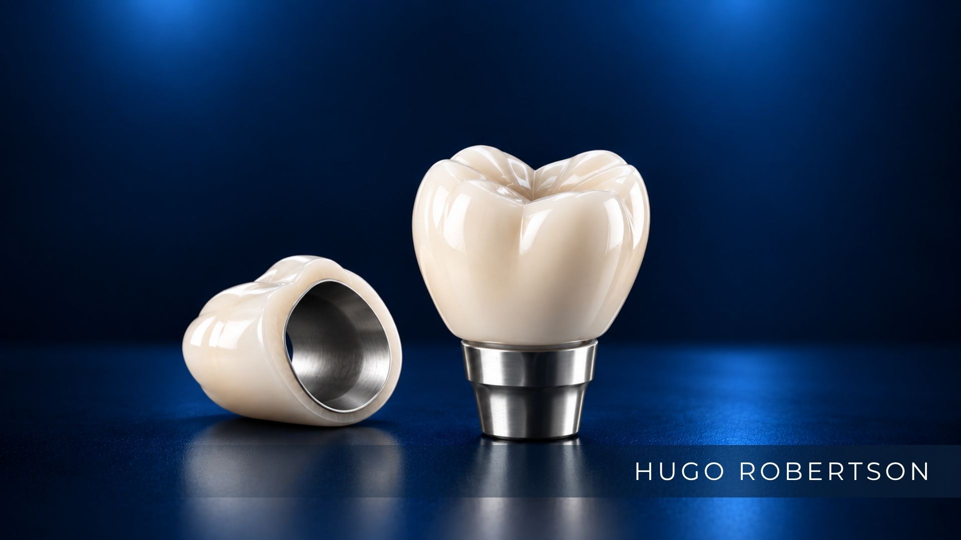 Coroa Dentária: o que é, tipos e quando é necessária