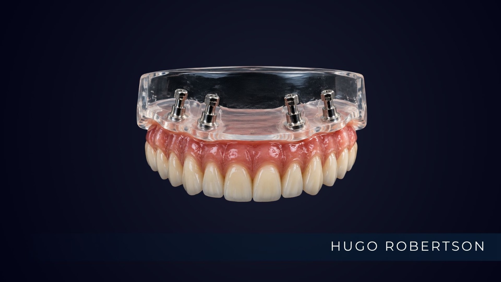 dr hugo protese protocolo 